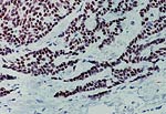 Immunocytochemical وصمة عار