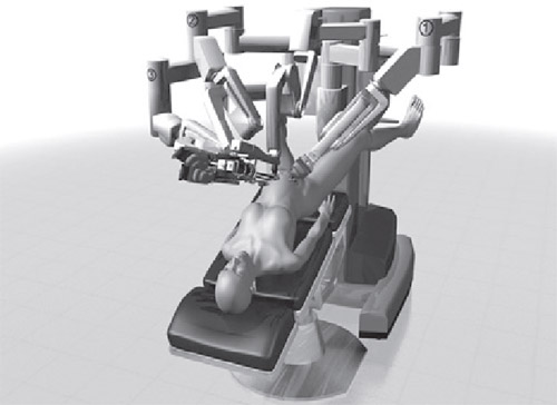 Positionnement des patients, mise en place et  l'amarrage du robot pour la robotique assiste chirurgies gyncologiques.
