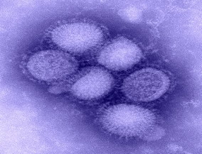 Negative-stained transmission electron micrograph depicting some of ultra-structural morphology of the A/CA/4/09 swine flu (H1N1) virus.