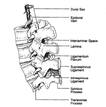 Details of the lumbar spinal column and epidural space. The epidural veins are largely restricted to the anterior and lateral epidural space. 