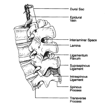 Dtails de la colonne spinale lombaire et de l'espace pidural.Les veines pidurales sont en grande partie limites  l'espace pidural antrieur et latral.