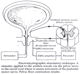 Electromyelographic stimulatory technique. A stimulus applied to the urethra travels via the pelvic nerve to the sacral cord where it causes activation of the pudendal motor nerve. Pelvic floor contraction results.