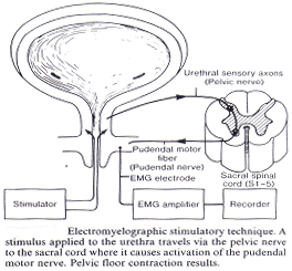 Electromyelographic محفزه تقنيه. حافزا لتطبيق الاحليل يسافر عبر الحوض العصبيه الى حبل المقدسة حيث تتسبب في تنشيط pudendal من المحركات الاعصاب. حوضي الكلمه انكماش النتائج.